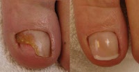 Voet nagels verzorging Schoonhoven - Welkom bij San’s Voetique - Pedicure en Cosmetische Voetverzorging San’s Voetique Pedicure in Schoonhoven